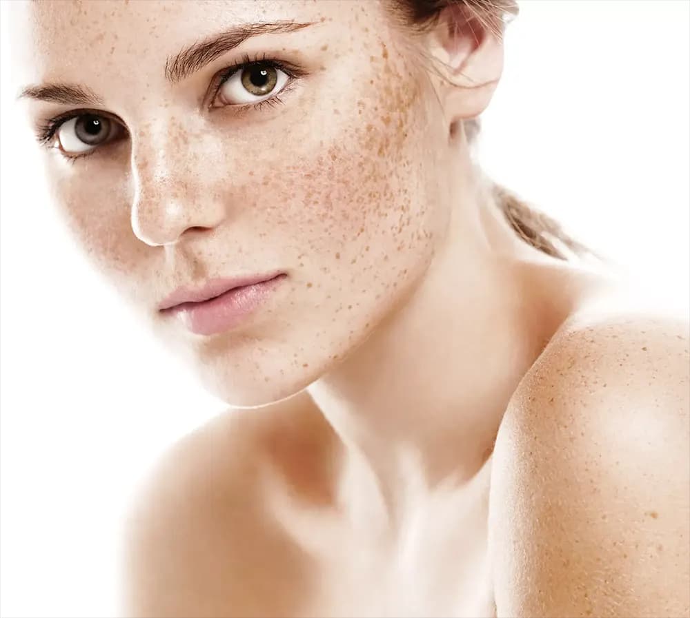 Pigmentation & Sun Damage